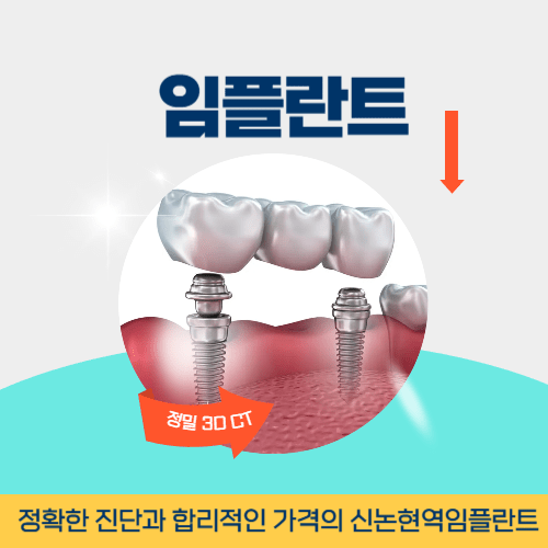 안동치과 안동시 치과 임플란트