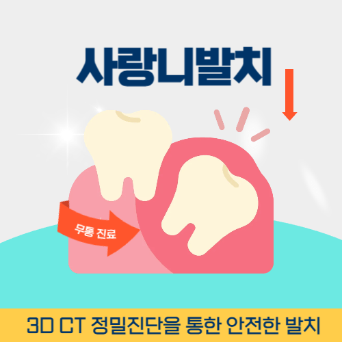 안동치과 안동시 치과 사랑니 발치