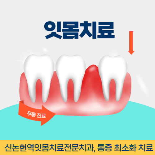 안동치과 안동시 치과 잇몸치료